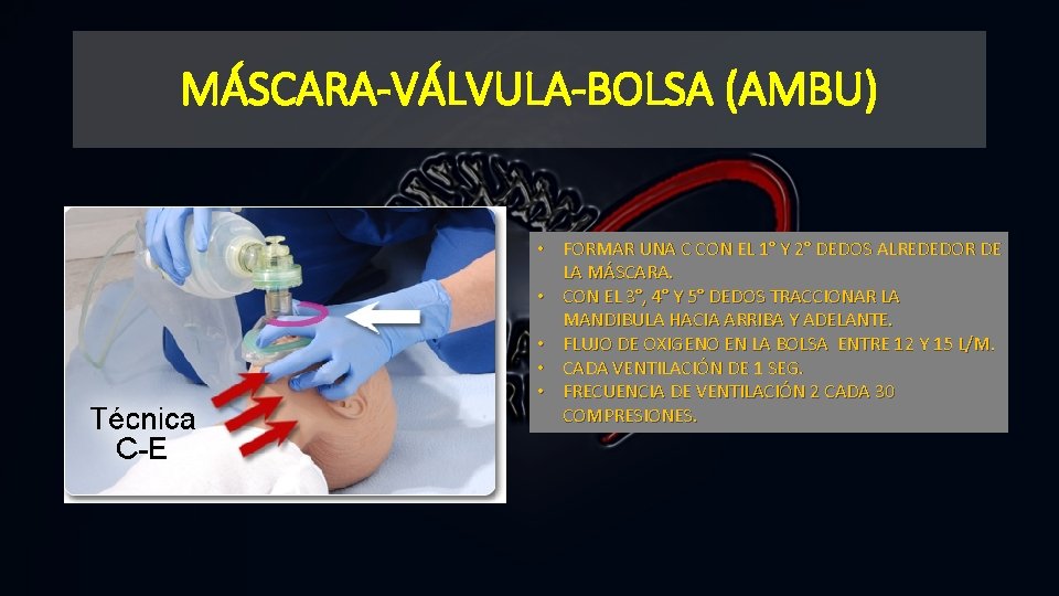 MÁSCARA-VÁLVULA-BOLSA (AMBU) • FORMAR UNA C CON EL 1° Y 2° DEDOS ALREDEDOR DE