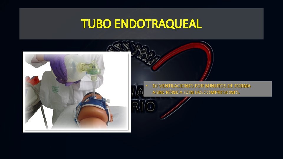 TUBO ENDOTRAQUEAL • 10 VENTILACIONES POR MINUTOS DE FORMA ASINCRÓNICA CON LAS COMPRESIONES. 