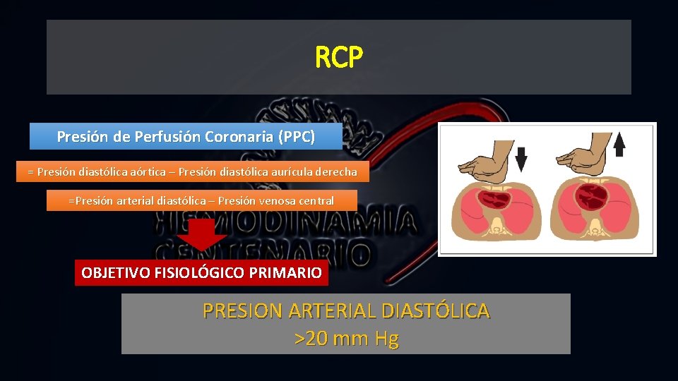 RCP Presión de Perfusión Coronaria (PPC) = Presión diastólica aórtica – Presión diastólica aurícula