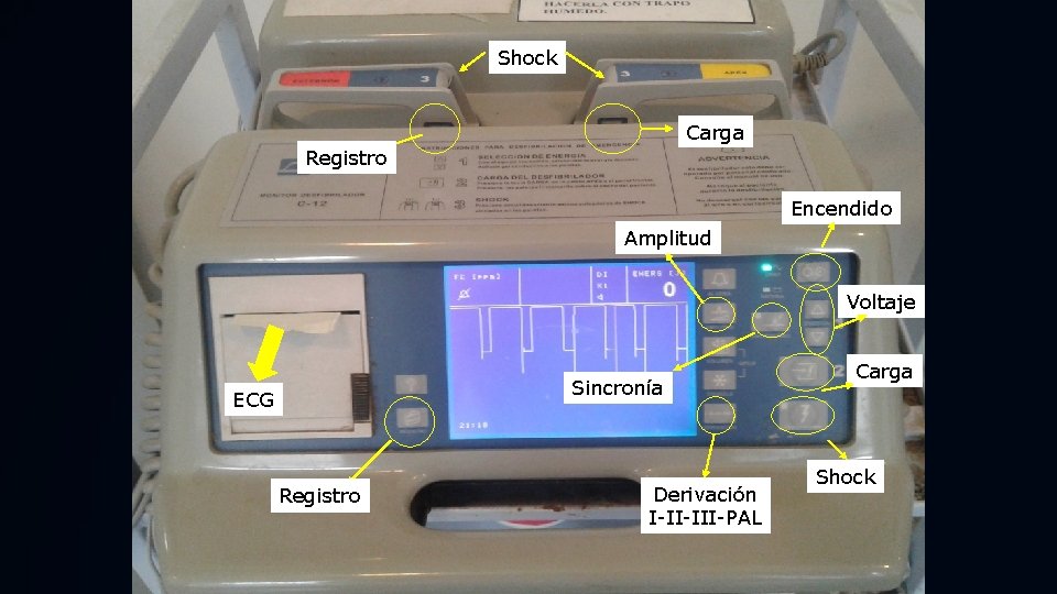 Shock Carga Registro Encendido Amplitud Voltaje Sincronía ECG Registro Derivación I-II-III-PAL Carga Shock 