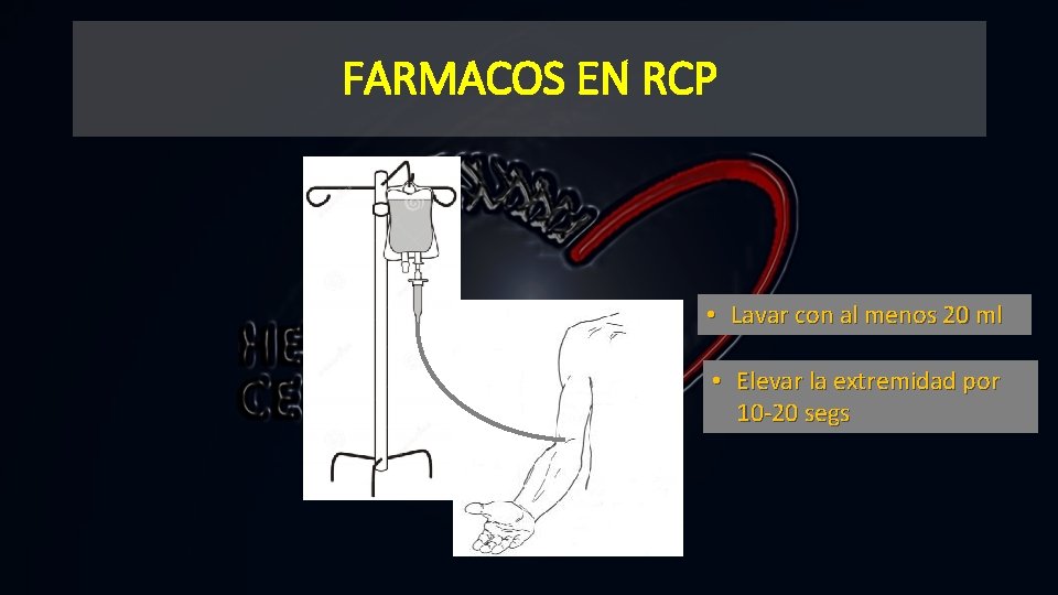 FARMACOS EN RCP • Lavar con al menos 20 ml • Elevar la extremidad