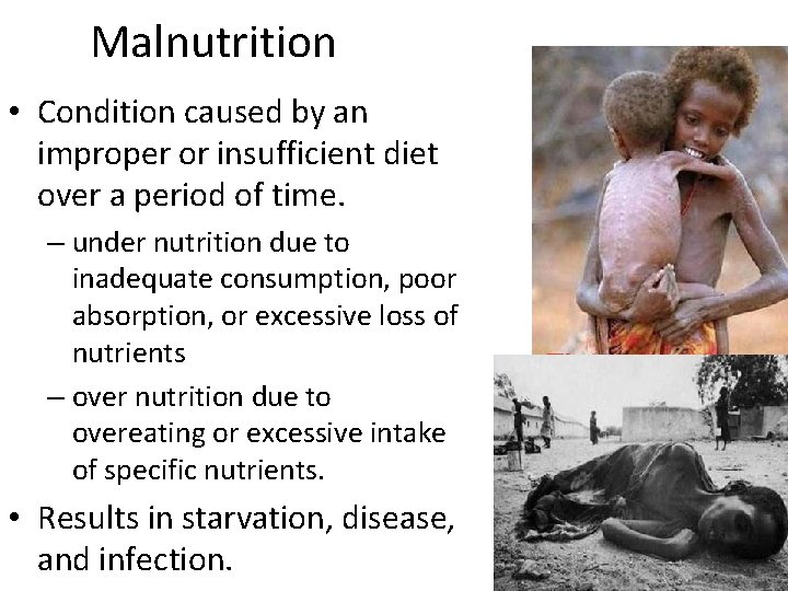 Malnutrition • Condition caused by an improper or insufficient diet over a period of