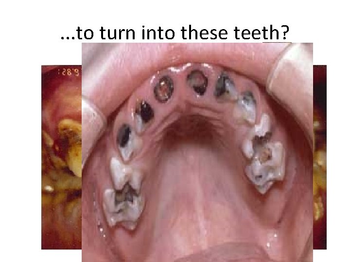 . . . to turn into these teeth? 