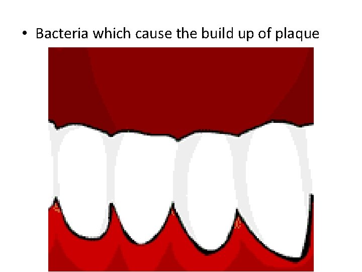  • Bacteria which cause the build up of plaque 