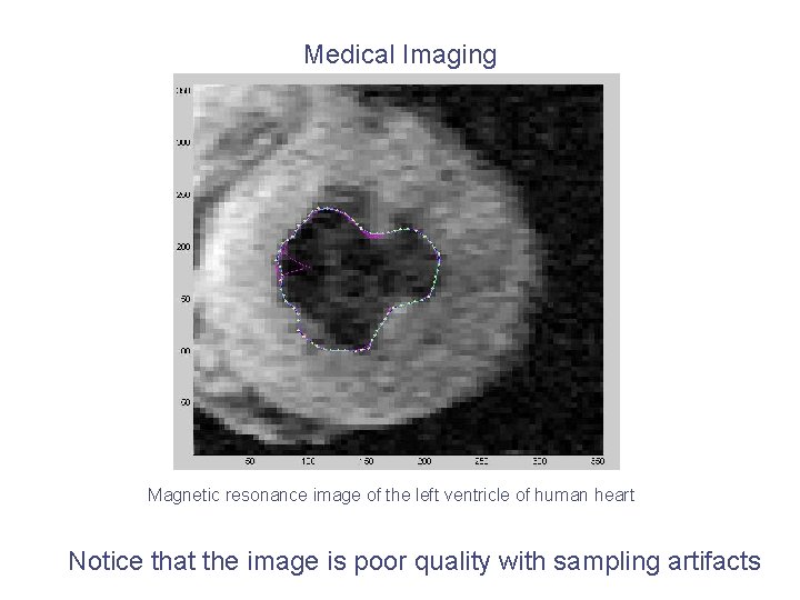 Medical Imaging Magnetic resonance image of the left ventricle of human heart Notice that