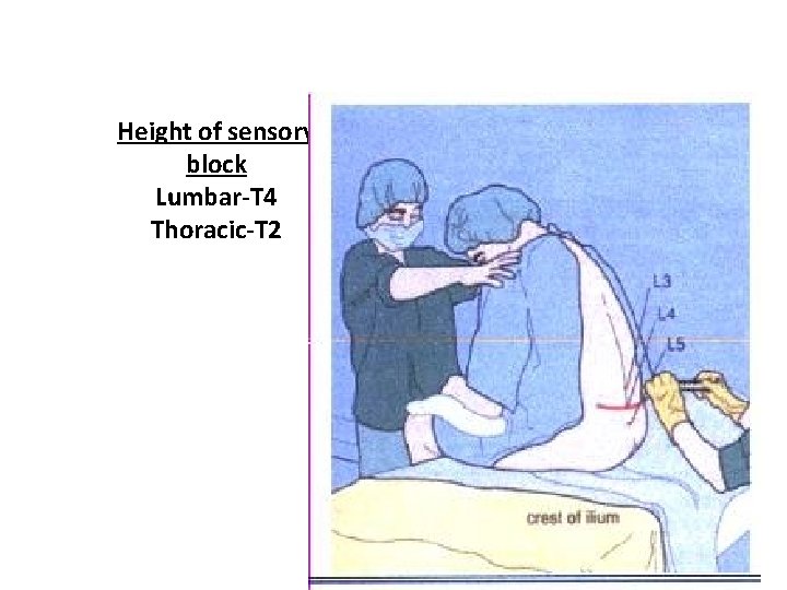 Height of sensory block Lumbar-T 4 Thoracic-T 2 