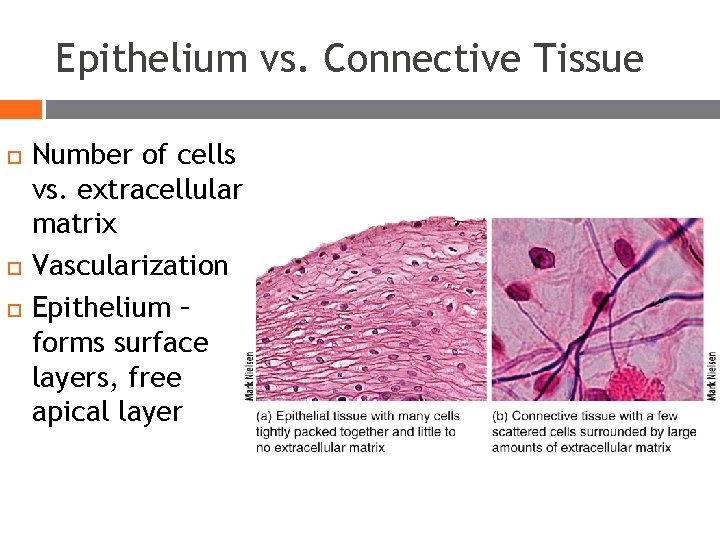 Epithelium vs. Connective Tissue Number of cells vs. extracellular matrix Vascularization Epithelium – forms Epithelium vs. Connective Tissue Number of cells vs. extracellular matrix Vascularization Epithelium – forms