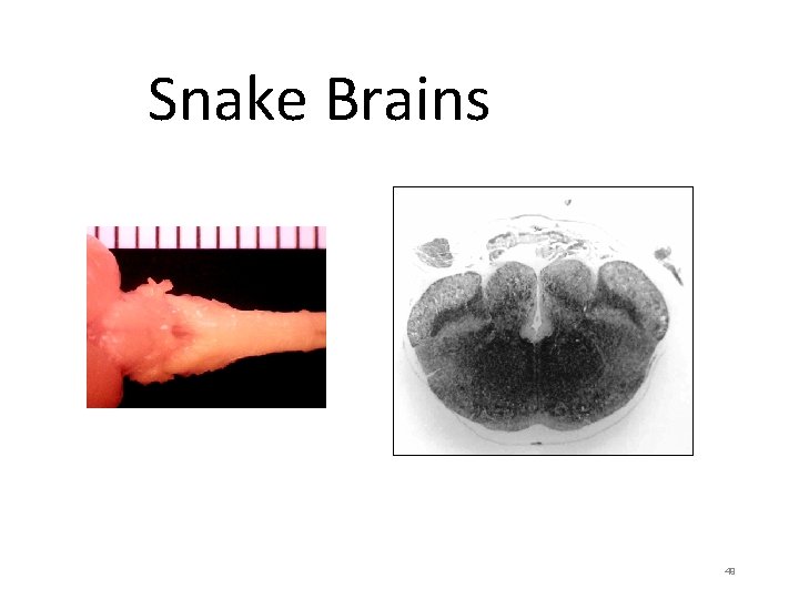 Snake Brains 49 