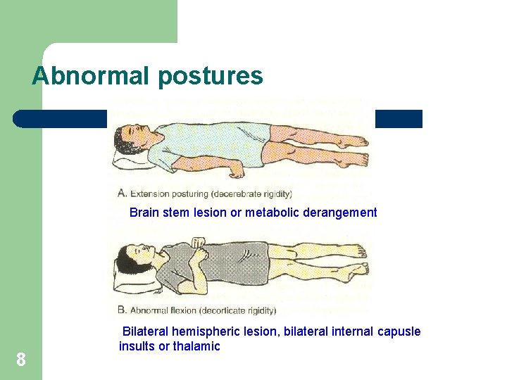 Abnormal postures Brain stem lesion or metabolic derangement 8 Bilateral hemispheric lesion, bilateral internal