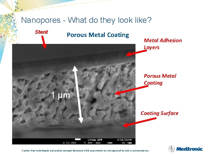 Nanopores - What do they look like? Stent Porous Metal Coating Metal Adhesion Layers