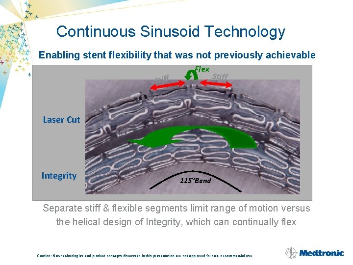Continuous Sinusoid Technology Enabling stent flexibility that was not previously achievable Stiff Flex Stiff