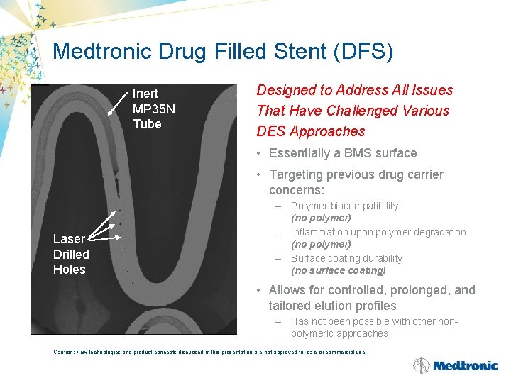 Medtronic Drug Filled Stent (DFS) Inert MP 35 N Tube Designed to Address All