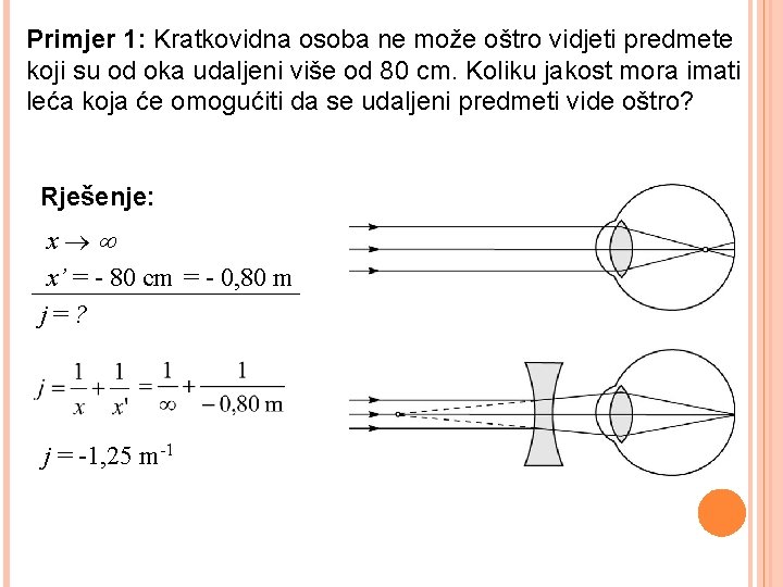 Primjer 1: Kratkovidna osoba ne može oštro vidjeti predmete koji su od oka udaljeni