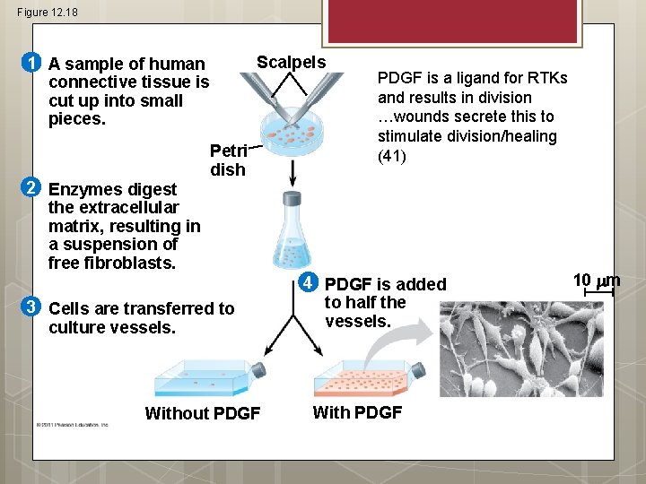 Figure 12. 18 Scalpels 1 A sample of human connective tissue is cut up