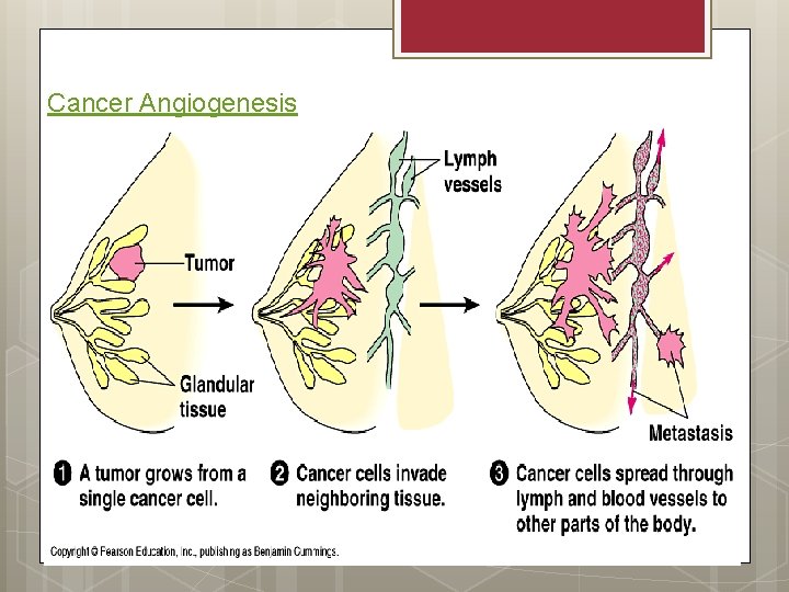 Cancer Angiogenesis 