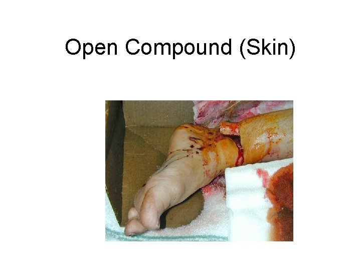 Open Compound (Skin) 