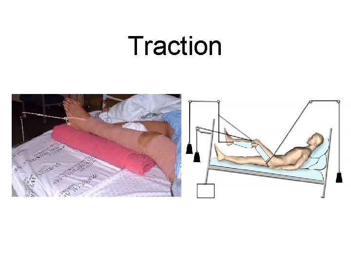 Traction 
