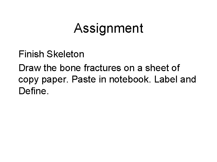 Assignment Finish Skeleton Draw the bone fractures on a sheet of copy paper. Paste