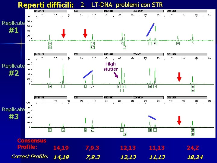 Reperti difficili: 2. LT-DNA: problemi con STR Replicate #1 High stutter Replicate #2 Replicate
