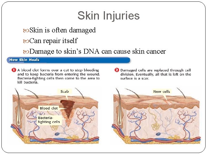 Skin Injuries Skin is often damaged Can repair itself Damage to skin’s DNA can