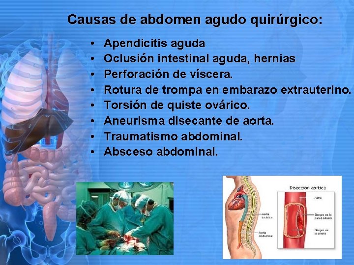 Causas de abdomen agudo quirúrgico: • • Apendicitis aguda Oclusión intestinal aguda, hernias Perforación