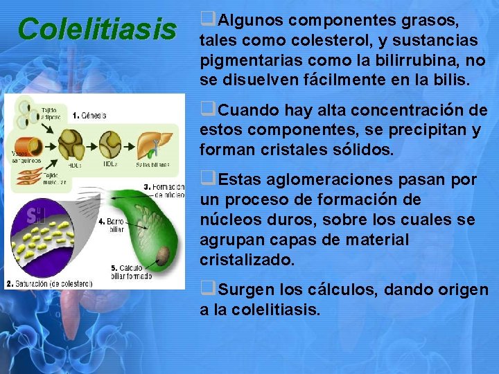 Colelitiasis q. Algunos componentes grasos, tales como colesterol, y sustancias pigmentarias como la bilirrubina,