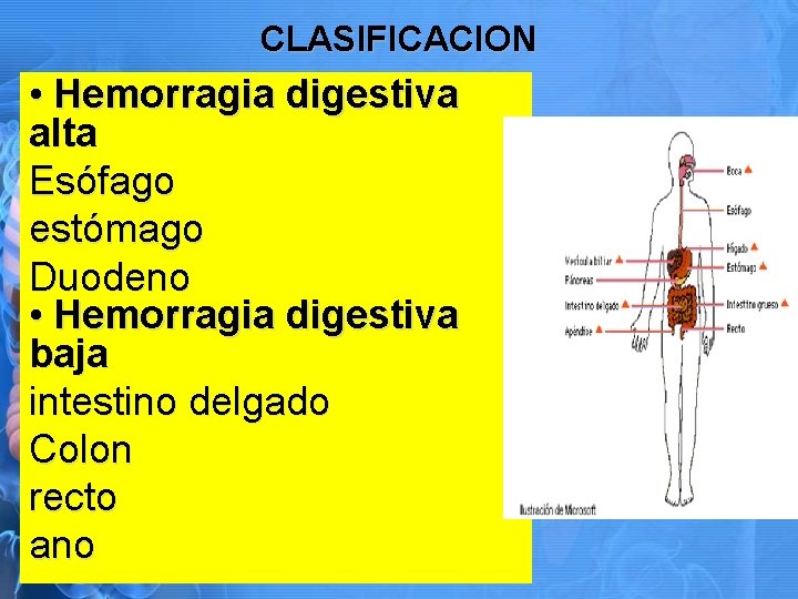 CLASIFICACION • Hemorragia digestiva alta Esófago estómago Duodeno • Hemorragia digestiva baja intestino delgado