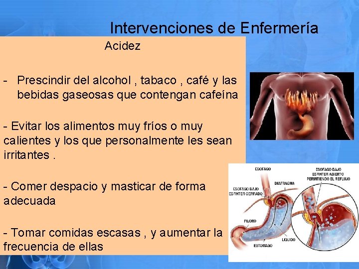 Intervenciones de Enfermería Acidez - Prescindir del alcohol , tabaco , café y las