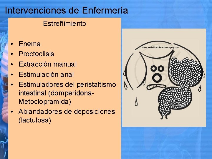 Intervenciones de Enfermería Estreñimiento • • • Enema Proctoclisis Extracción manual Estimulación anal Estimuladores