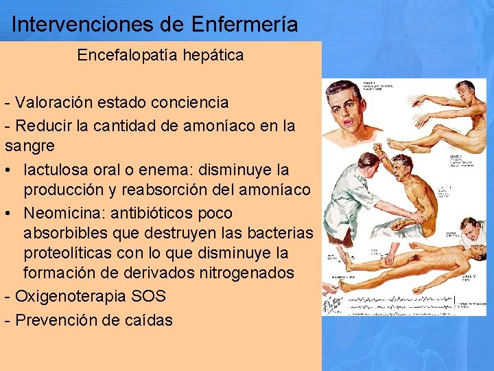 Intervenciones de Enfermería Encefalopatía hepática - Valoración estado conciencia - Reducir la cantidad de