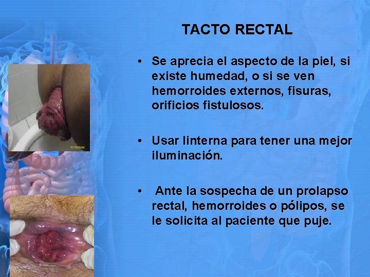 TACTO RECTAL • Se aprecia el aspecto de la piel, si existe humedad, o