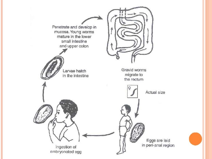 Enterobiosis protozoa, Enterobiosis és giardiasis - Enterobiasis protozoa