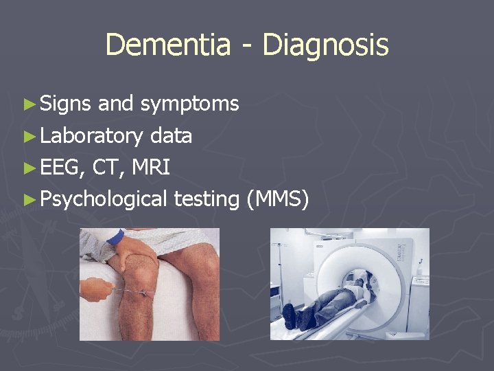 Dementia - Diagnosis ► Signs and symptoms ► Laboratory data ► EEG, CT, MRI