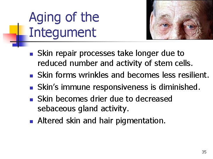 Aging of the Integument n n n Skin repair processes take longer due to Aging of the Integument n n n Skin repair processes take longer due to