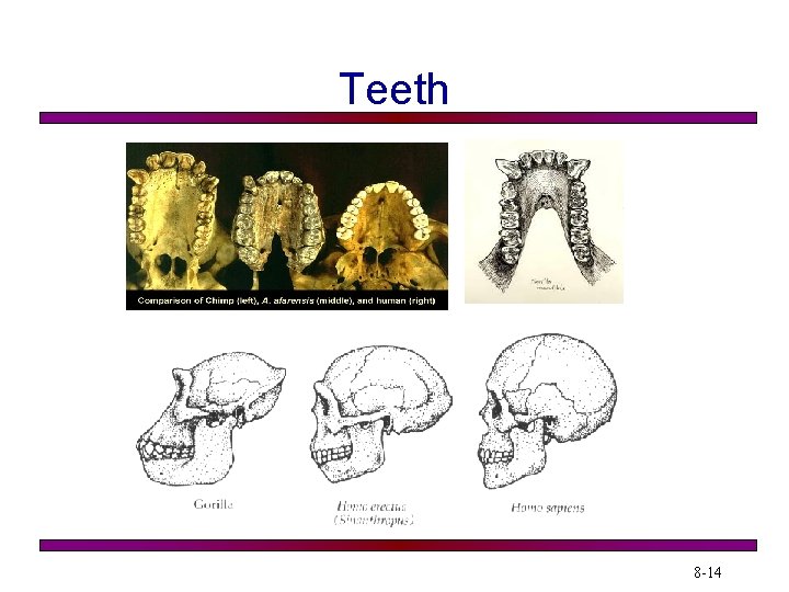 Teeth 8 -14 