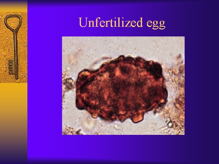 Unfertilized egg 