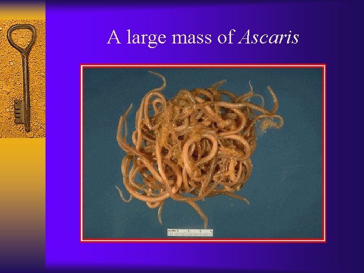 A large mass of Ascaris 