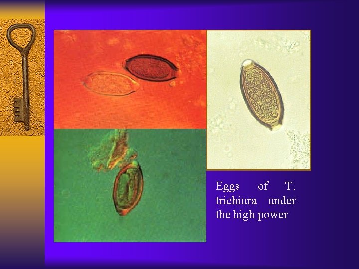 Eggs of T. trichiura under the high power 