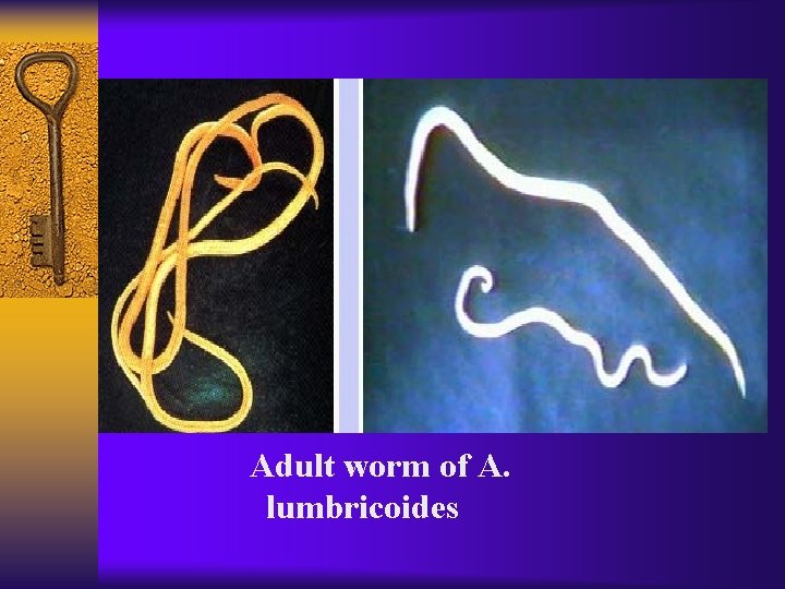 Adult worm of A. lumbricoides 