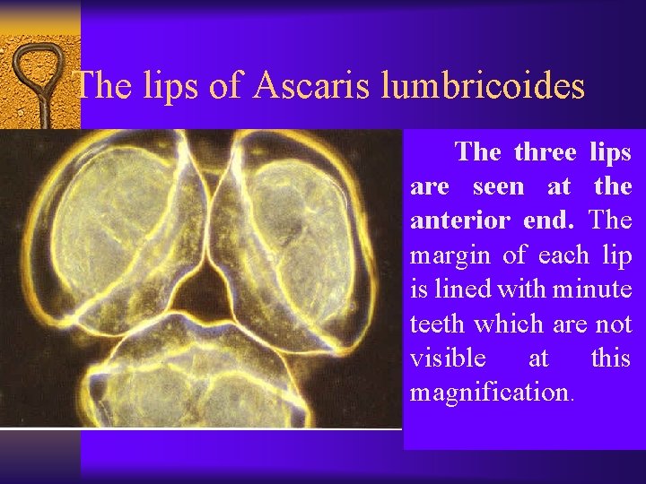 The lips of Ascaris lumbricoides The three lips are seen at the anterior end.