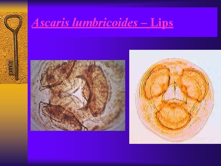 Ascaris lumbricoides – Lips 