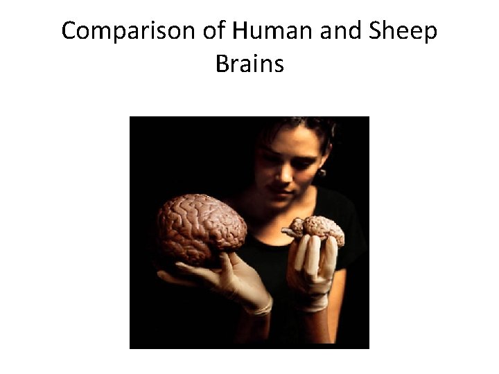 Comparison of Human and Sheep Brains 