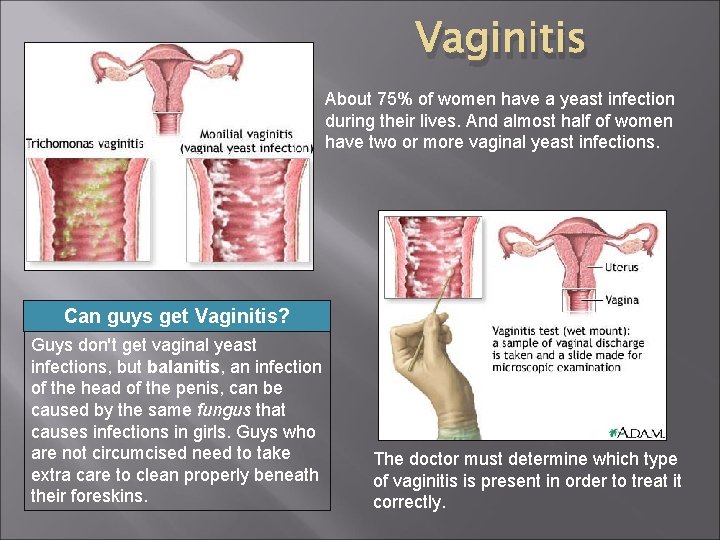 Vaginitis About 75% of women have a yeast infection during their lives. And almost