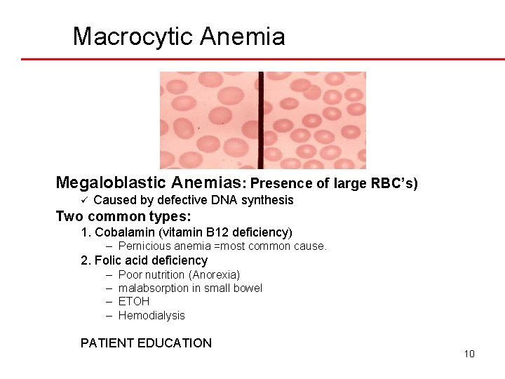 Macrocytic Anemia Megaloblastic Anemias: Presence of large RBC’s) ü Caused by defective DNA synthesis