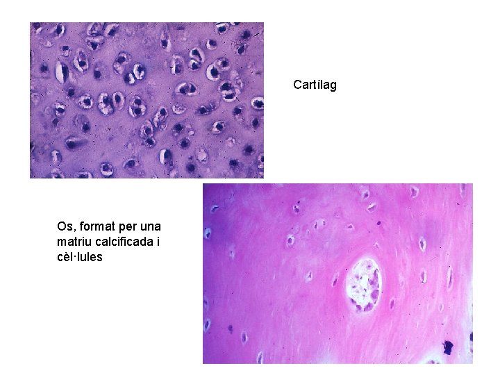 Cartílag Os, format per una matriu calcificada i cèl·lules 