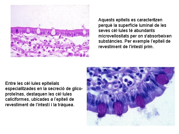 Aquests epitelis es caracteritzen perquè la superfície luminal de les seves cèl·lules té abundants