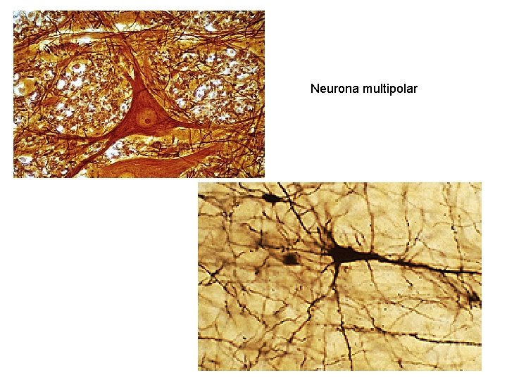 Neurona multipolar 