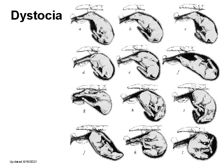 Dystocia Updated: 6/18/2021 