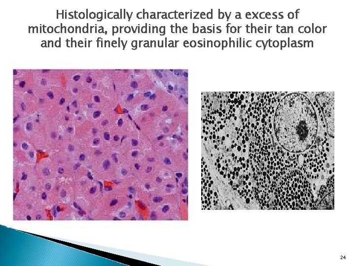 Histologically characterized by a excess of mitochondria, providing the basis for their tan color