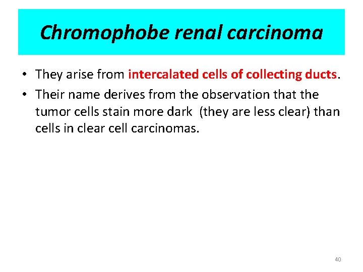 Chromophobe renal carcinoma • They arise from intercalated cells of collecting ducts. • Their